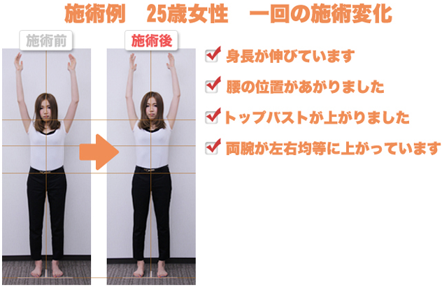 施工例　２５歳女性　１回の施術変化　①身長が伸びています。②腰の位置が上がりました。③トップバストが上がりました。④両腕が左右均等に上がっています。